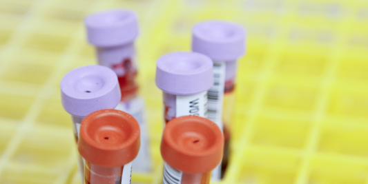 Why Blood Tests Can't Diagnose Histamine Intolerance